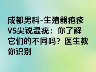 成都男科-生殖器疱疹VS尖锐湿疣：你了解它们的不同吗？医生教你识别