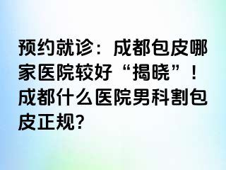 预约就诊：成都包皮哪家医院较好“揭晓”！成都什么医院男科割包皮正规？