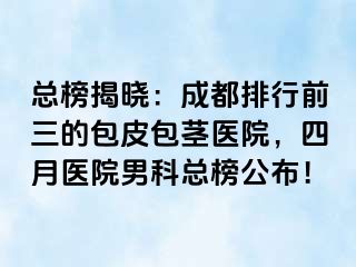 总榜揭晓：成都排行前三的包皮包茎医院，四月医院男科总榜公布！